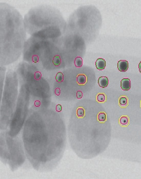 Unicomp Foreign Material Stone Glass Metal Ceramic X Ray Detection Machine For Food Package